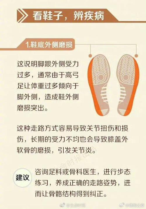 这种踩屎感鞋正在一步步毁掉你的脚从鞋子磨损看出身体情况剖档