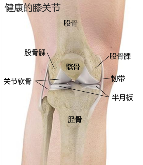 骨性结构形成膝关节的基本框架包括股骨髁大腿骨下端胫骨小腿骨